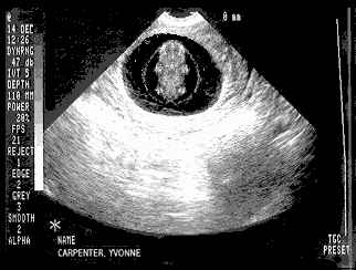 Baby Carpenter working out