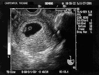 Baby Carpenter at 6 weeks